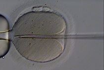 first-ivf-baby-cell–invitro.jpg