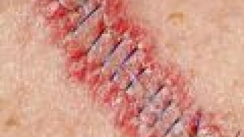 Scar tissue process revealed