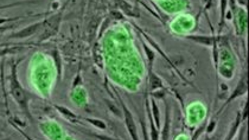 Bone “scaffold” helps new bones grow from stem cells