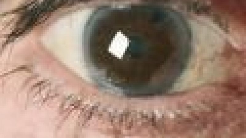 Glaucoma Begins With Brain Nerve Deterioration :: Understanding Animal ...