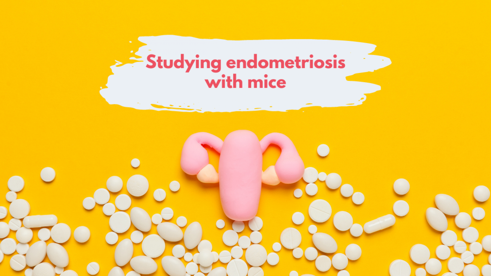 Endometriosis: a painful lack of research