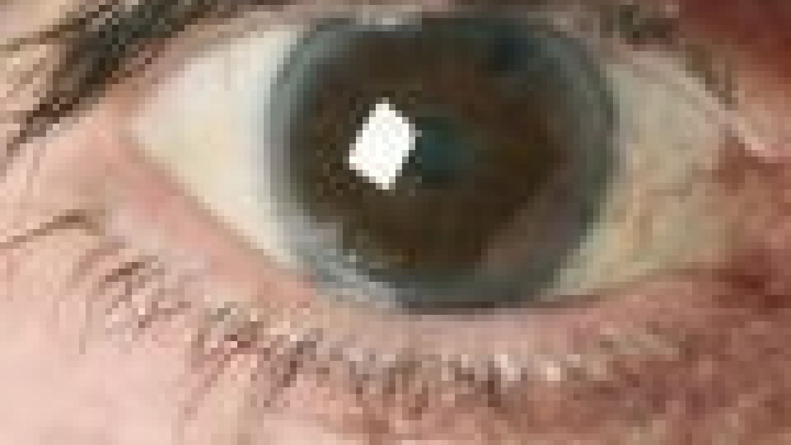 Glaucoma begins with brain nerve deterioration